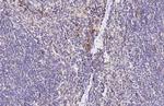 CCR4 Antibody in Immunohistochemistry (Paraffin) (IHC (P))