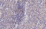 CCR4 Antibody in Immunohistochemistry (Paraffin) (IHC (P))