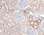 Prolactin Receptor Antibody in Immunohistochemistry (Paraffin) (IHC (P))