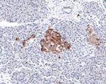 Prolactin Receptor Antibody in Immunohistochemistry (Paraffin) (IHC (P))