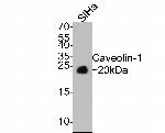 Caveolin 1 Antibody in Western Blot (WB)