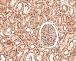 MAPKAP1 Antibody in Immunohistochemistry (Paraffin) (IHC (P))