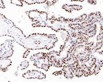 p21 Antibody in Immunohistochemistry (Paraffin) (IHC (P))