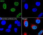 BRG1 Antibody in Immunohistochemistry (Paraffin) (IHC (P))