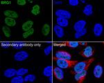 BRG1 Antibody in Immunohistochemistry (Paraffin) (IHC (P))