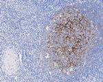 CD35 Antibody in Immunohistochemistry (Paraffin) (IHC (P))