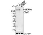 CD35 Antibody in Western Blot (WB)