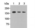 TOP2A Antibody in Western Blot (WB)