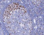 MUM1 Antibody in Immunohistochemistry (Paraffin) (IHC (P))