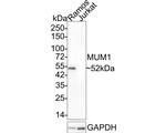 MUM1 Antibody in Western Blot (WB)