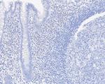 SALL4 Antibody in Immunohistochemistry (Paraffin) (IHC (P))