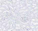 SALL4 Antibody in Immunohistochemistry (Paraffin) (IHC (P))