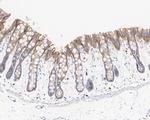 K-Ras Antibody in Immunohistochemistry (Paraffin) (IHC (P))