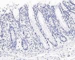 NAPSA Antibody in Immunohistochemistry (Paraffin) (IHC (P))