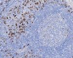 Kappa Light Chain Antibody in Immunohistochemistry (Paraffin) (IHC (P))