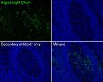 Kappa Light Chain Antibody in Immunohistochemistry (Paraffin) (IHC (P))