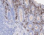 Kappa Light Chain Antibody in Immunohistochemistry (Paraffin) (IHC (P))