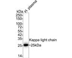Kappa Light Chain Antibody in Western Blot (WB)