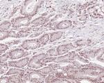 MLH1 Antibody in Immunohistochemistry (Paraffin) (IHC (P))