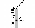 Human IgA Antibody in Western Blot (WB)