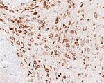 GRP78 Antibody in Immunohistochemistry (Paraffin) (IHC (P))