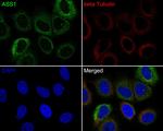 ASS1 Antibody in Immunocytochemistry (ICC/IF)