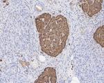 Chromogranin A Antibody in Immunohistochemistry (Paraffin) (IHC (P))