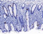 Chromogranin A Antibody in Immunohistochemistry (Paraffin) (IHC (P))