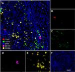 CD57 Antibody in Immunohistochemistry (PFA fixed) (IHC (PFA))