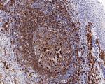 CD79a Antibody in Immunohistochemistry (Paraffin) (IHC (P))