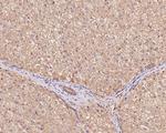 Bax Antibody in Immunohistochemistry (Paraffin) (IHC (P))