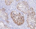 p16INK4a Antibody in Immunohistochemistry (Paraffin) (IHC (P))