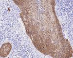 p16INK4a Antibody in Immunohistochemistry (Paraffin) (IHC (P))