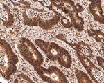 PIN4 Antibody in Immunohistochemistry (Paraffin) (IHC (P))