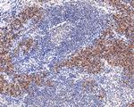 PREB Antibody in Immunohistochemistry (Paraffin) (IHC (P))