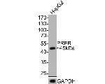 PREB Antibody in Western Blot (WB)