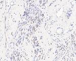 Estrogen Receptor alpha Antibody in Immunohistochemistry (Paraffin) (IHC (P))