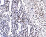 Estrogen Receptor alpha Antibody in Immunohistochemistry (Paraffin) (IHC (P))