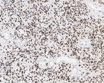 SOX2 Antibody in Immunohistochemistry (Paraffin) (IHC (P))