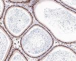 Androgen Receptor Antibody in Immunohistochemistry (Paraffin) (IHC (P))