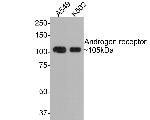 Androgen Receptor Antibody in Western Blot (WB)