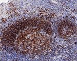 CD22 Antibody in Immunohistochemistry (Paraffin) (IHC (P))