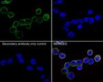 CD21 Antibody in Immunocytochemistry (ICC/IF)