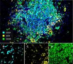 CD21 Antibody in Immunohistochemistry (PFA fixed) (IHC (PFA))