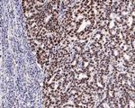 MSH6 Antibody in Immunohistochemistry (Paraffin) (IHC (P))