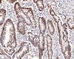 MSH6 Antibody in Immunohistochemistry (Paraffin) (IHC (P))