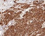 DOG-1 Antibody in Immunohistochemistry (Paraffin) (IHC (P))