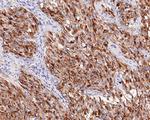 Calcitonin Antibody in Immunohistochemistry (Paraffin) (IHC (P))