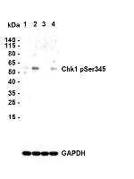 Phospho-CHK1 (Ser345) Antibody in Western Blot (WB)