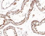 eIF4E Antibody in Immunohistochemistry (Paraffin) (IHC (P))